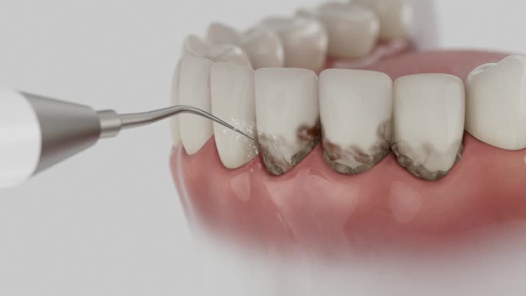 Reliable Dental Implants contractor in Annandale, VA by Smile Center Dentistry